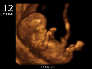 12_week_ultrasound_3d