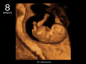 8_week_ultrasound_3d